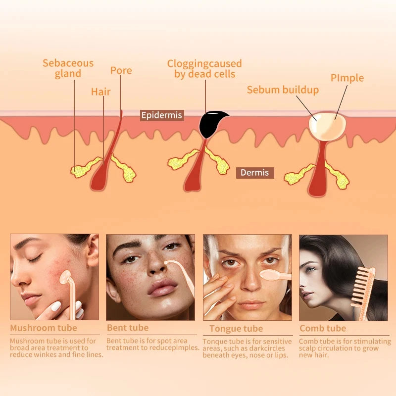 4-in-1 HIGH FREQUENCY ELECTROTHERAPY WAND