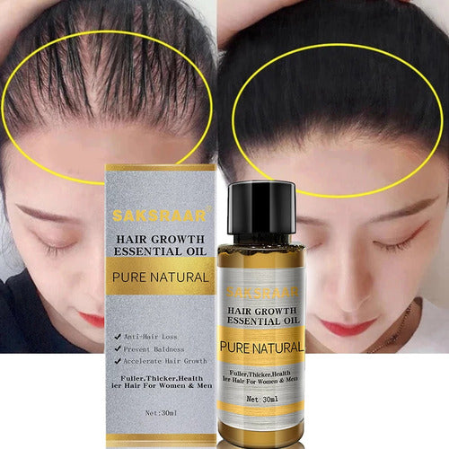 HAIR GROWTH OIL