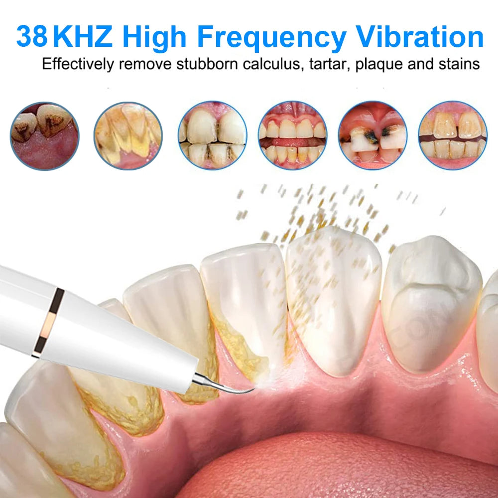 ULTRASONIC DENTAL TEETH PLAQUE REMOVER & CLEANER