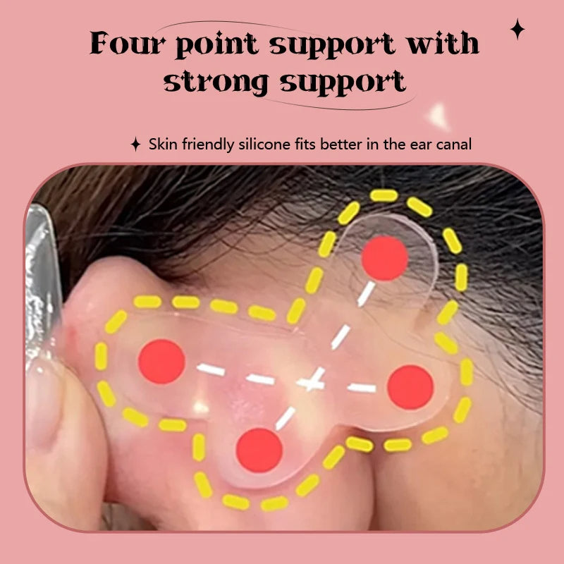 EAR CORRECTOR STICKERS