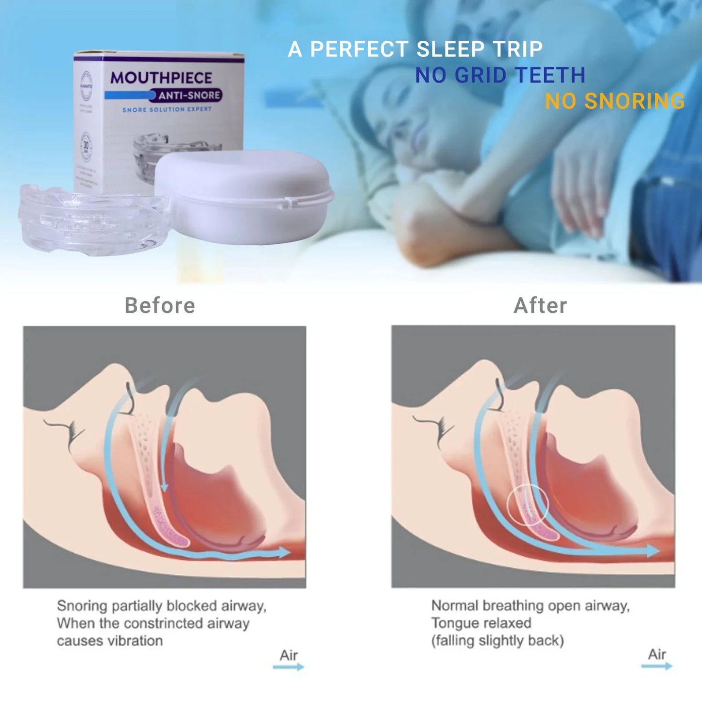ANTI-SNORING MOUTH GUARD