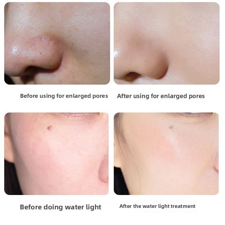 Electric Micro Needle