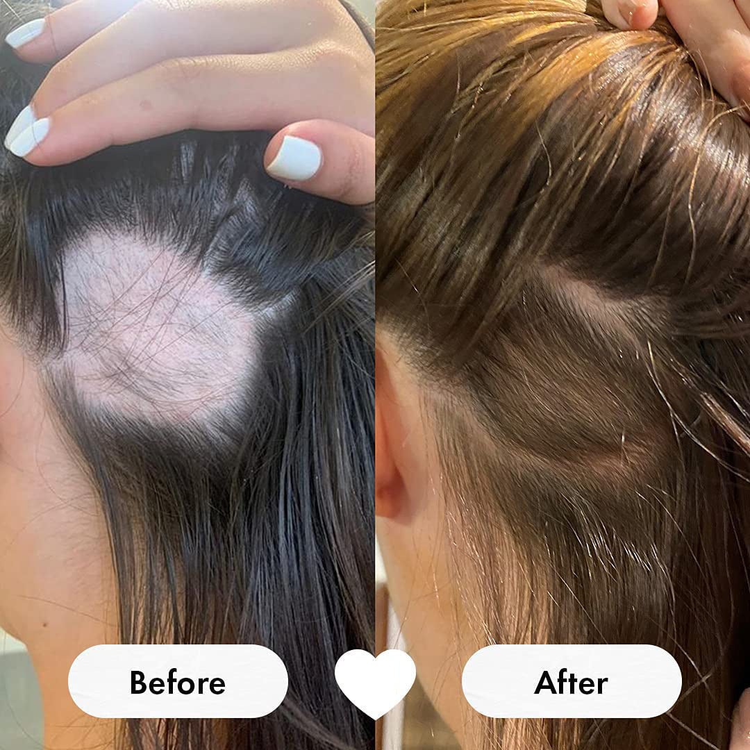 Hair Vitamin Gummies